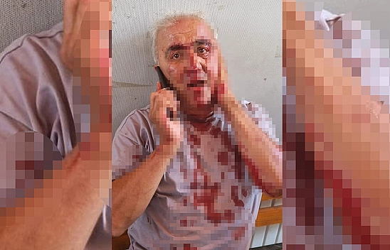 Yolcu, Minibüs Şoförünün Kulağını Isırarak Koparttı