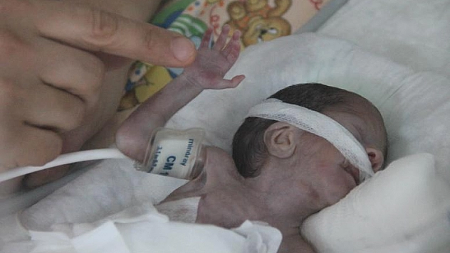 500 GRAM AĞIRLIĞINDA PARMAK BEBEK DÜNYAYA GELDİ 
