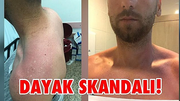 Eski Elazığspor'luyu dövdüler!