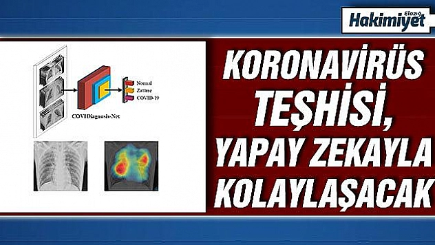 Koronavirüs teşhisini kolaylaştıracak yapay zeka sistemi