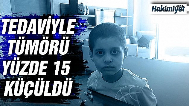 Tedavisini Cumhurbaşkanı Erdoğan üstlenmişti, tümörü yüzde 15 küçüldü