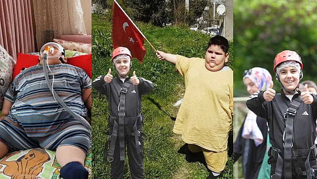 5 Yaşında 90 kiloydu: Hastalıkla başlayan zor hayat umuda dönüştü