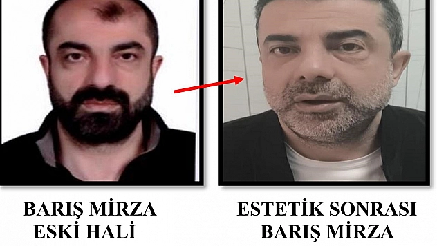 Ameliyat ile yüzünü değiştiren firari cinayet zanlısı, 7 yıl sonra yakalandı