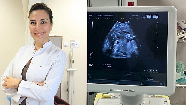 Anne karnındaki bebeğe stent takıldı