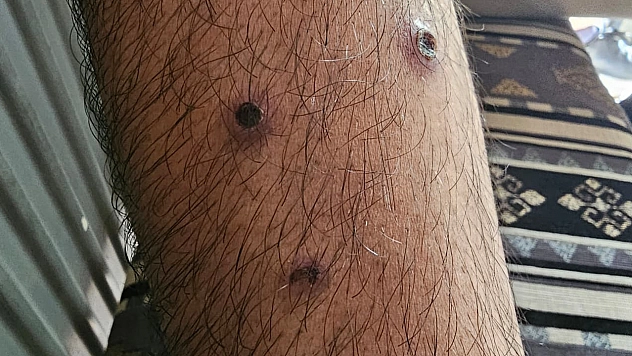 Berberin 'ben ilacı' vaadi vatandaşı mağdur etti