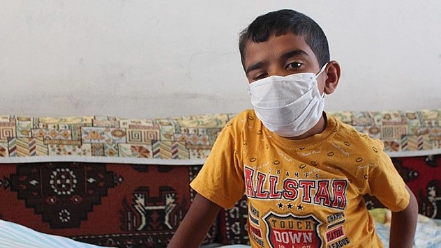 Bir gözünü kaybetti, 10 ameliyat geçirdi, 2 operasyonu kaldı