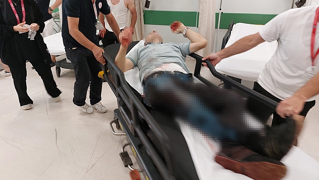 Düğünde Kazara Kendini Vurdu