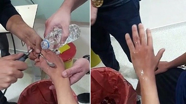 Elazığ'da itfaiyeden yüzük çıkarma operasyonu