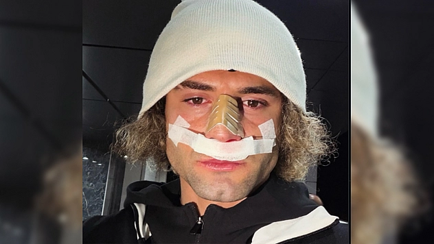 Elazığspor'da Fuat Bavuk'tan fedakarlık: burnu kırıldı, sahayı terk etmedi