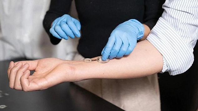 Enfeksiyonu günler öncesinden tespit eden akıllı bandaj çıktı