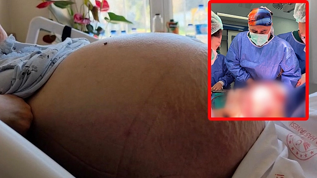 Kabızlık sandı, karnından 22 kiloluk tümör çıktı