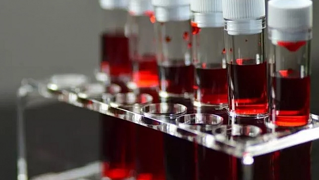 Kansere en yatkın kan grupları belli oldu!