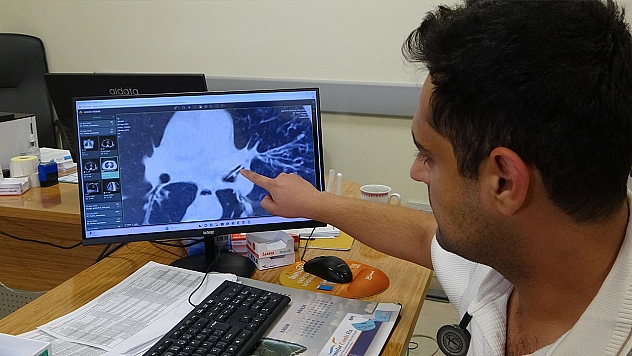 Kansersin, astımsın dediler: Akciğerinden kabak çekirdeği çıktı