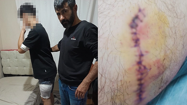Liseli çocuk bıçaklandı!