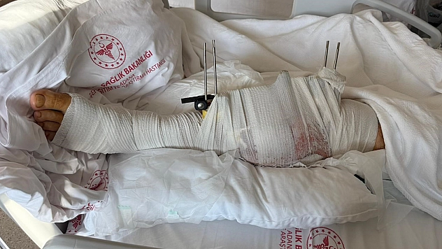 Muhtar, yeniden evlilik hazırlığı yapan eski damadını vurdu