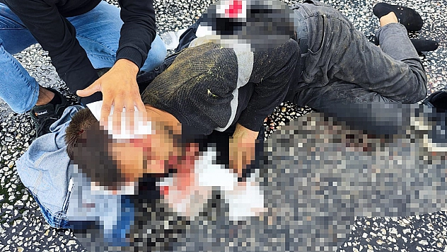 Otomobil Takla Attı