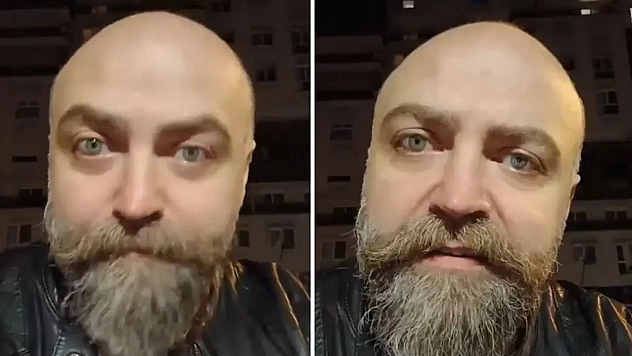 Saçsız adam isyan etti! Berbere ödediği ücret dudak uçuklattı