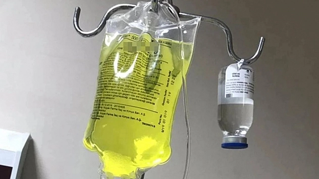 Sağlık Bakanlığı'ndan kritik 'Sarı serum' açıklaması!