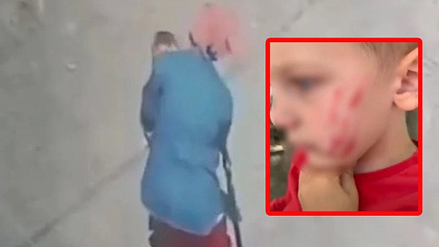 Sokakta oynayan çocuk dehşeti yaşadı
