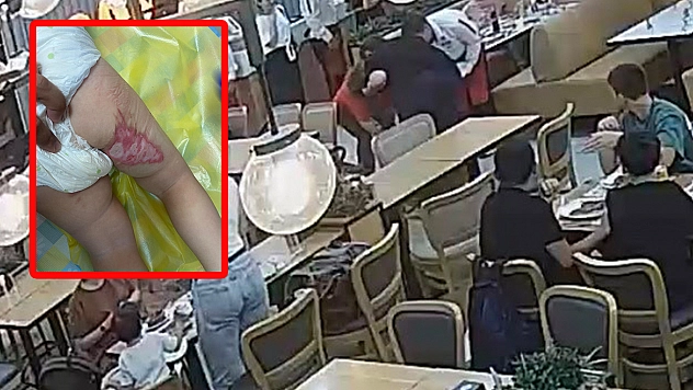 Tereyağı şovu kabusa döndü: 2 yaşındaki bebek ağır yaralandı