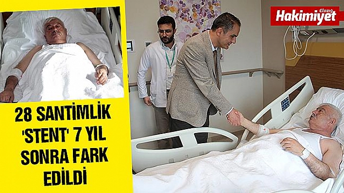 UNUTULAN 28 SANTİMLİK 'STENT' 7 YIL SONRA FARK EDİLDİ