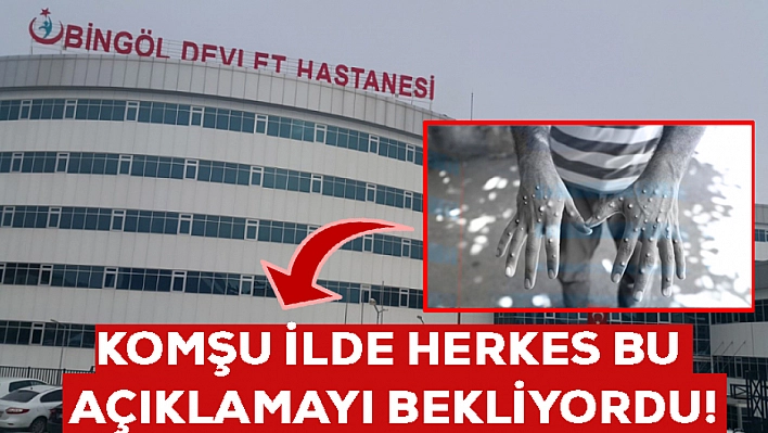 Elazığ'a komşu olan ilde Maymun Çiçeği Virüsü açıklaması! Herkes diken üzerinde bekledi… İşte gelen açıklama