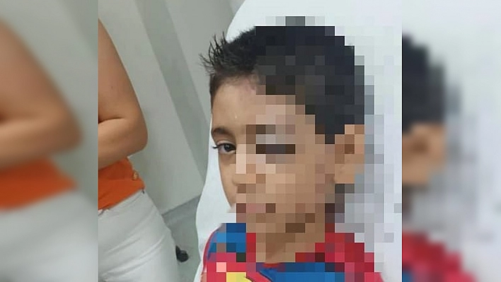Elazığ'da skandal: Polisin Dövdüğü Çocuk Ağır Yaralandı