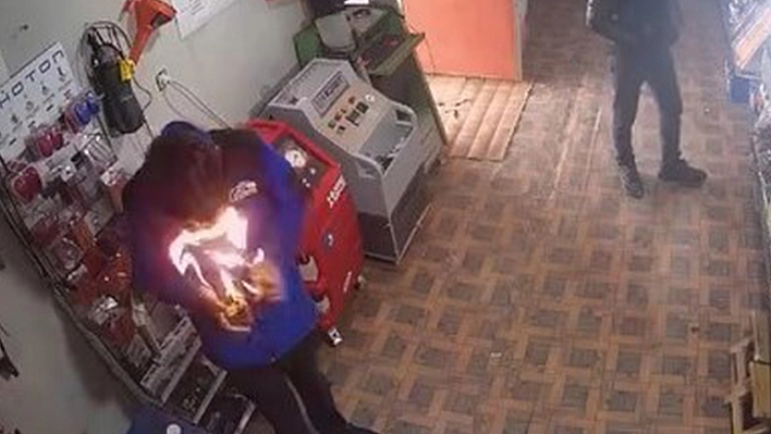 Elazığ'da ilginç anlar: Çakmağı çakınca yüzü alevlerin arasında kaldı