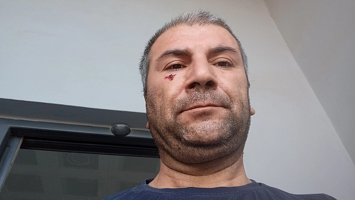 'Kenara çekilir misiniz' diyerek uyardı, dayak yedi