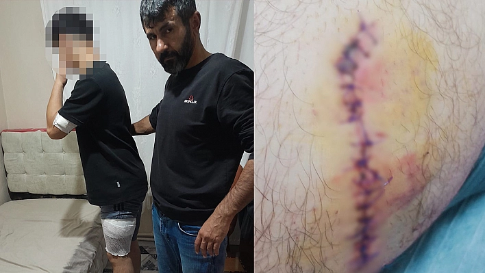 Liseli çocuk bıçaklandı!