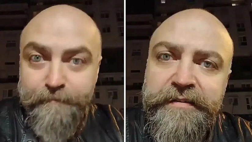 Saçsız adam isyan etti! Berbere ödediği ücret dudak uçuklattı