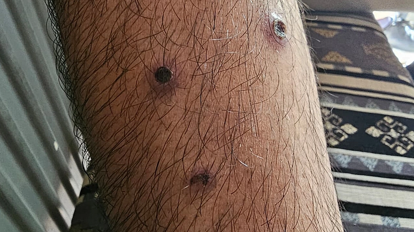 Berberin 'ben ilacı' vaadi vatandaşı mağdur etti