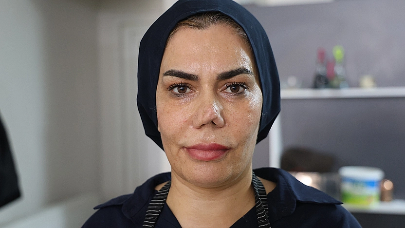 Elazığ'da 4 burun ameliyat sonrası hayatı kabusa döndü