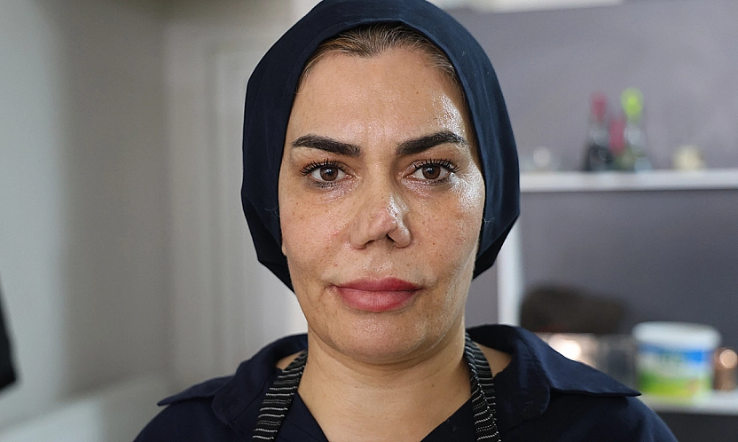 Elazığ'da 4 burun ameliyat sonrası hayatı kabusa döndü