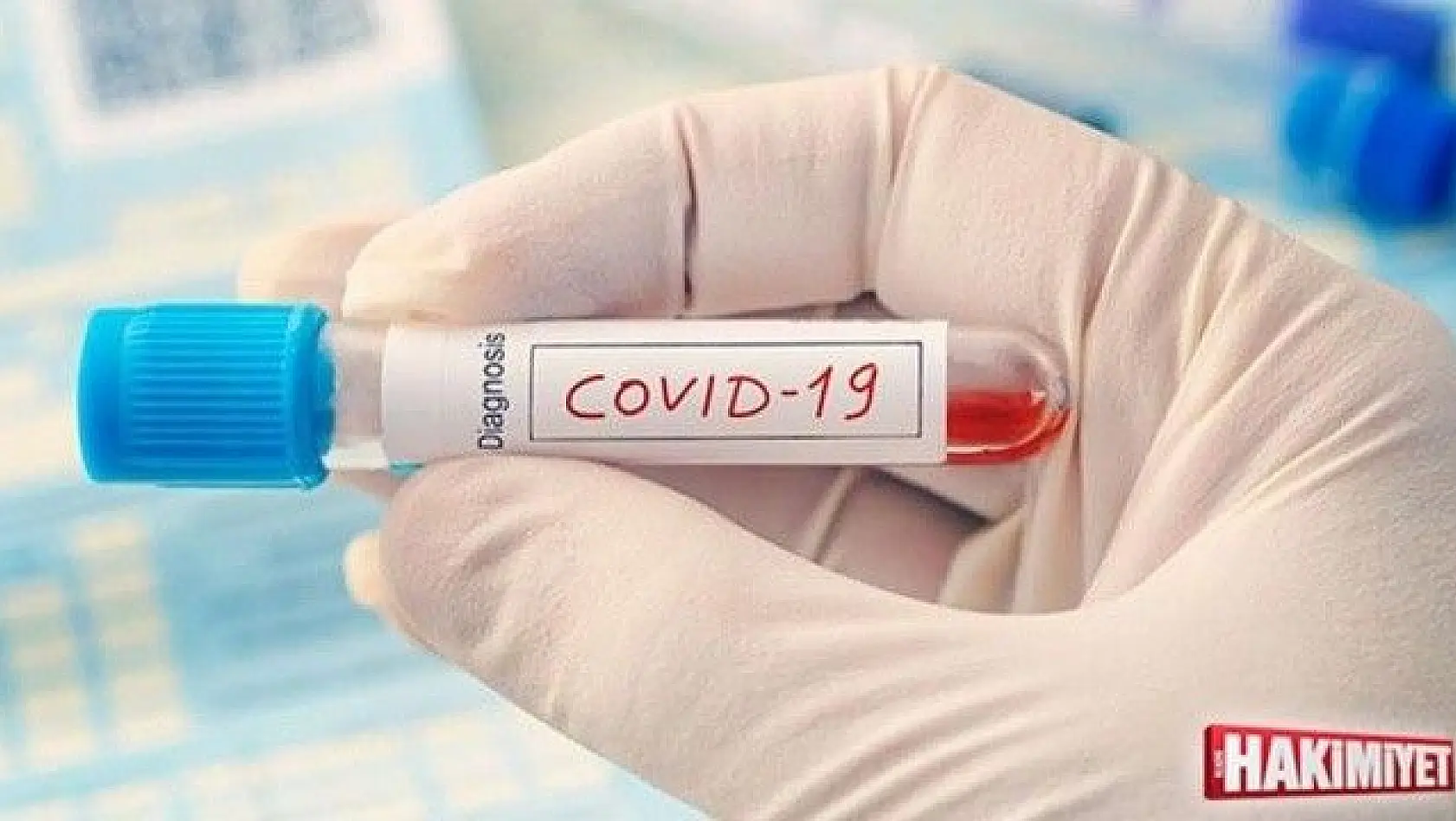 Koronavirüs için yeni tedavi yöntemi