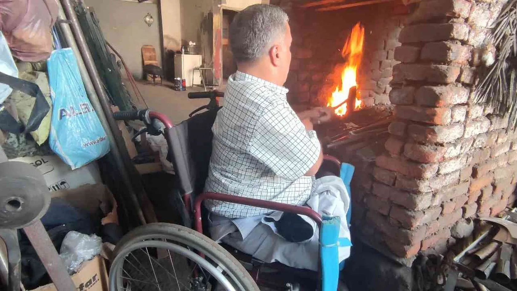 Depremde henüz 40 günlükken 2 bacağını kaybetti, yaşama azmini kaybetmedi