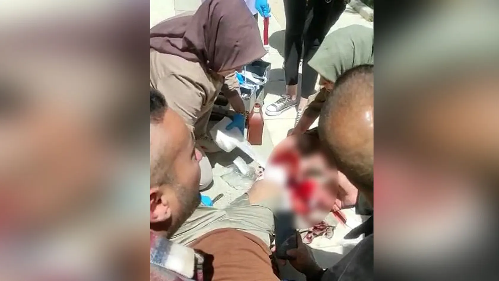 Elazığ'da silahlı saldırı:1 yaralı