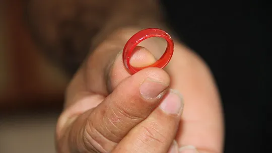 Oyun oynarken yerdeki yüzüğü yutan 3 yaşındaki çocuk ölümden döndü