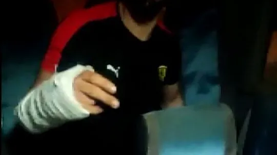 Minibüste yolculuk yaparken elini koltuğun arasına sıkıştırdı