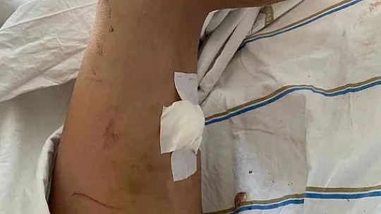 Sevgilisini darp edip 5 yerinden bıçaklamıştı, ilk duruşmada kendini savundu