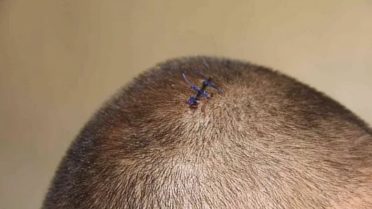 Aile Kavgasında 2 Yaralı, Sebebi Pes Dedirtecek Cinsten
