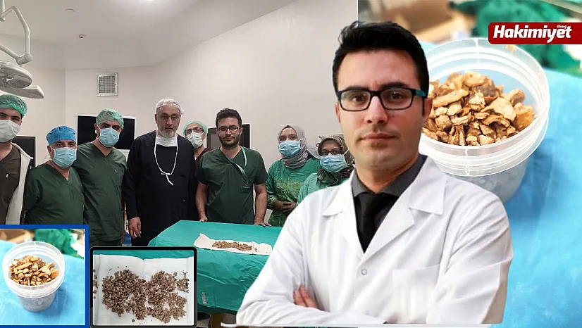 Böbreğinde 13 Cm Büyüklüğünde Taş Tespit Edilen Hasta Sağlığına Kavuştu